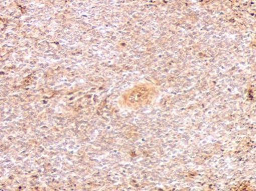 Porcine Circovirus Type 2 Capsid Antibody in Immunohistochemistry (Paraffin) (IHC (P))