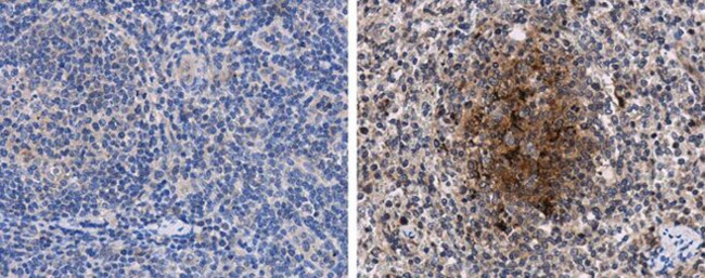 Porcine Circovirus Type 2 Capsid Antibody in Immunohistochemistry (Paraffin) (IHC (P))