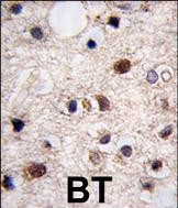 JMJD3 Antibody in Immunohistochemistry (Paraffin) (IHC (P))