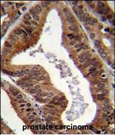 EAP2 Antibody in Immunohistochemistry (Paraffin) (IHC (P))