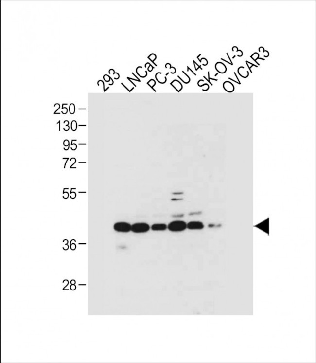 STRA8 Antibody in Western Blot (WB)