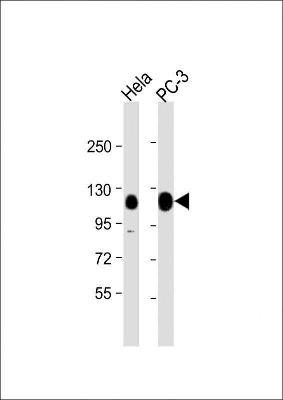 TRIM28 Antibody in Western Blot (WB)