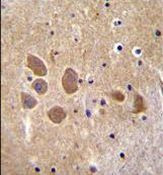 AP1M1 Antibody in Immunohistochemistry (Paraffin) (IHC (P))