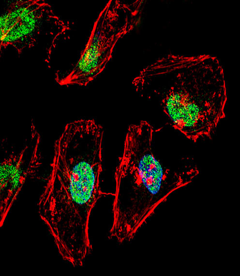 TBX6 Antibody in Immunocytochemistry (ICC/IF)