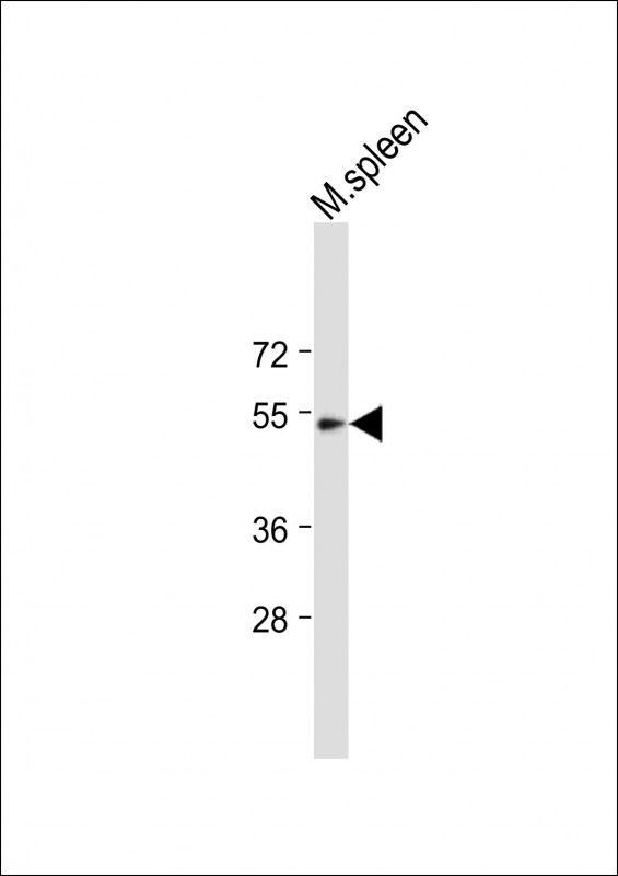 TBX6 Antibody in Western Blot (WB)