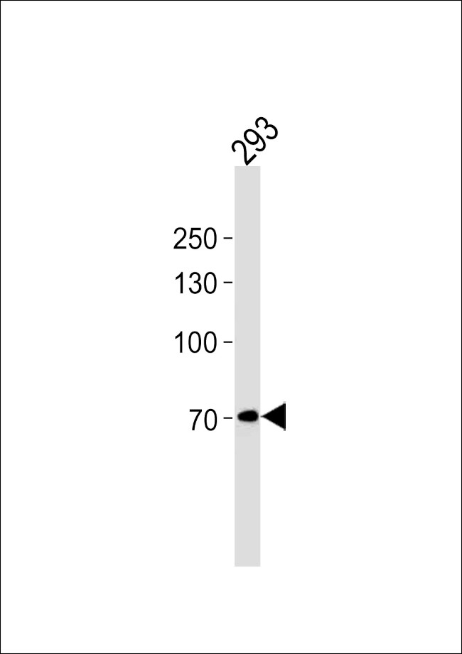 POU6F2 Antibody in Western Blot (WB)