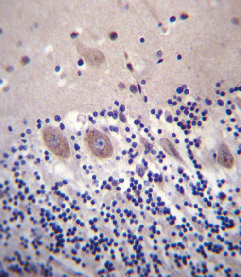 CACNA2D2 Antibody in Immunohistochemistry (Paraffin) (IHC (P))