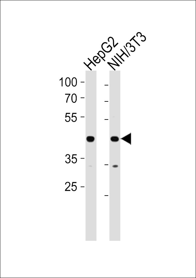 NR2F2 Antibody in Western Blot (WB)