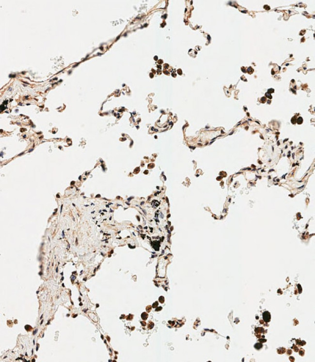 SMAD9 Antibody in Immunohistochemistry (Paraffin) (IHC (P))