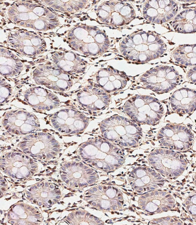 SMAD9 Antibody in Immunohistochemistry (Paraffin) (IHC (P))