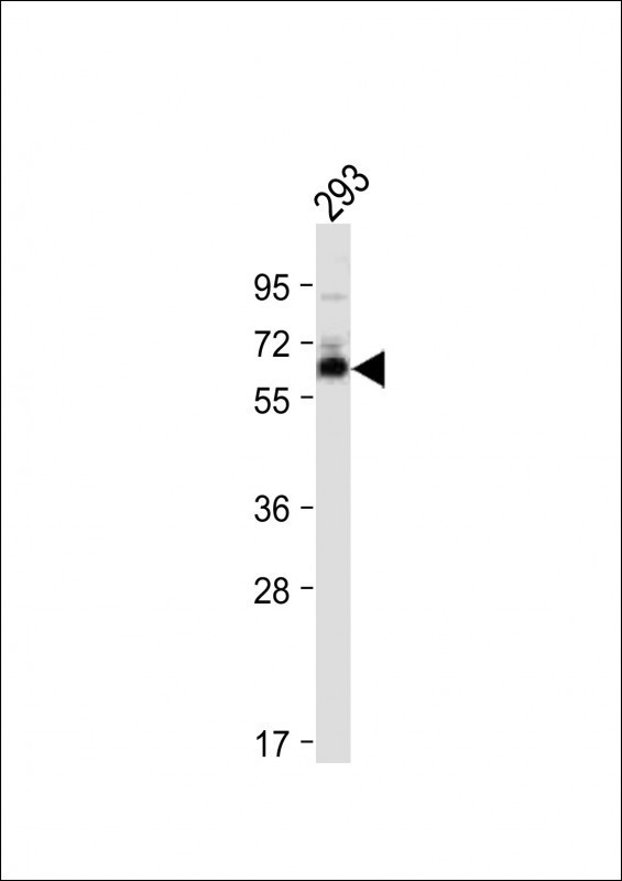 SMAD9 Antibody in Western Blot (WB)