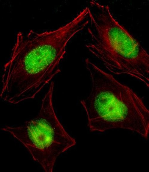 MTGR1 Antibody in Immunocytochemistry (ICC/IF)