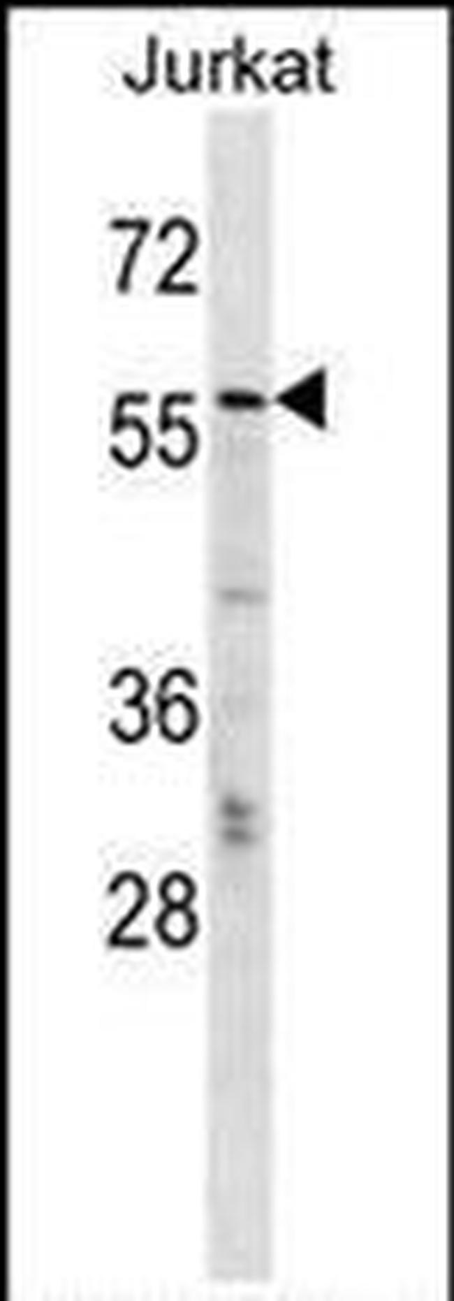 MTGR1 Antibody in Western Blot (WB)