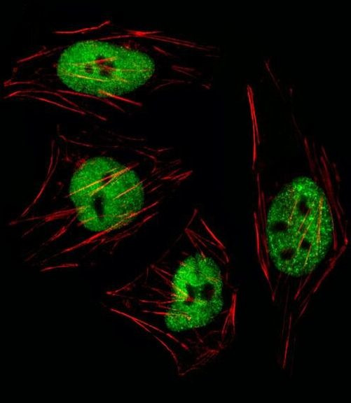 GTF2I Antibody in Immunocytochemistry (ICC/IF)