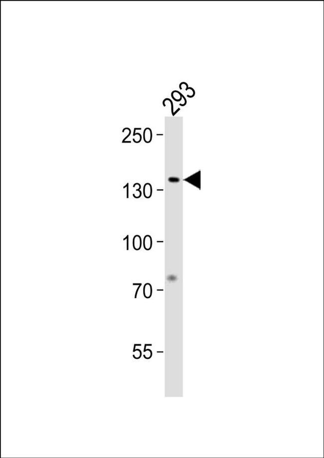 GTF2I Antibody in Western Blot (WB)