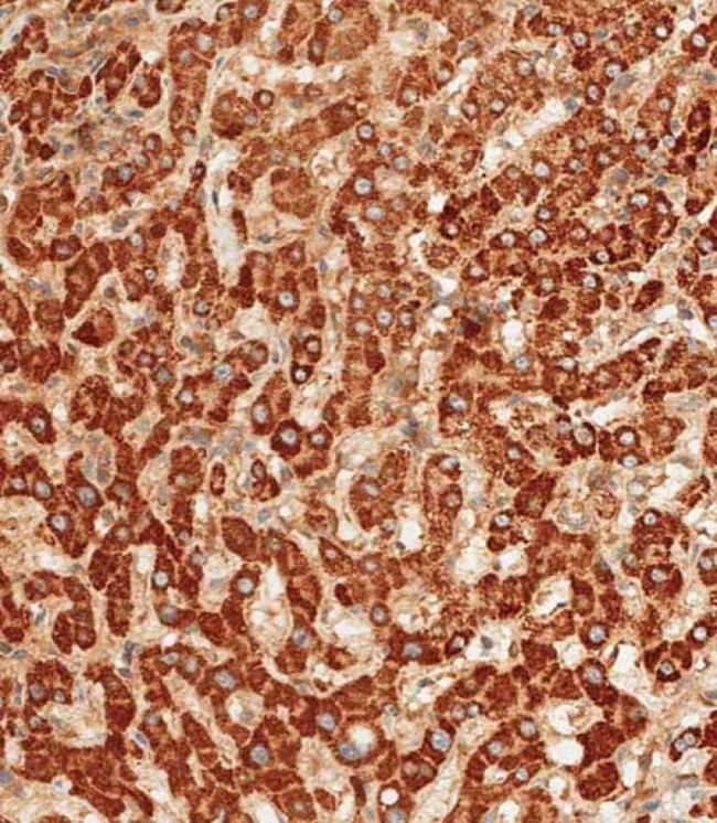 ATG7 Antibody in Immunohistochemistry (Paraffin) (IHC (P))