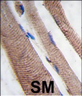 VPS34 Antibody in Immunohistochemistry (Paraffin) (IHC (P))