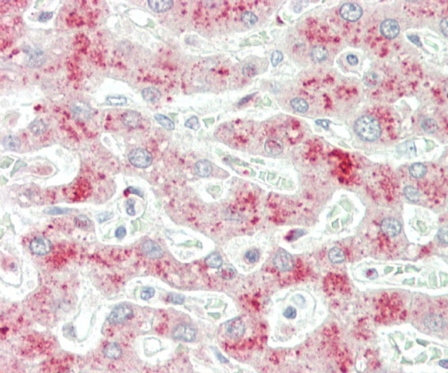 VPS34 Antibody in Immunohistochemistry (Paraffin) (IHC (P))