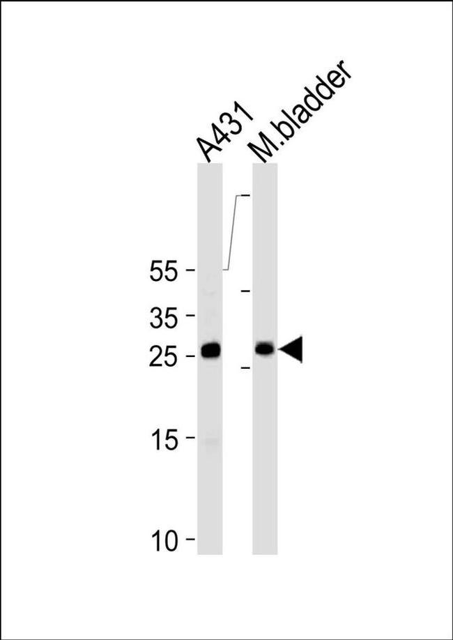 14-3-3 sigma Antibody in Western Blot (WB)