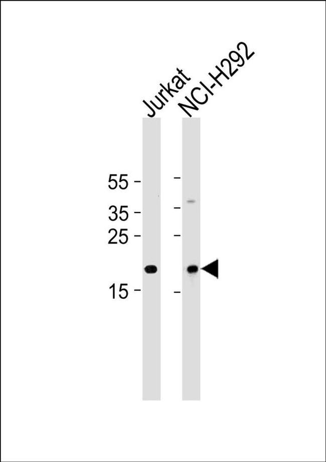 TAF10 Antibody in Western Blot (WB)