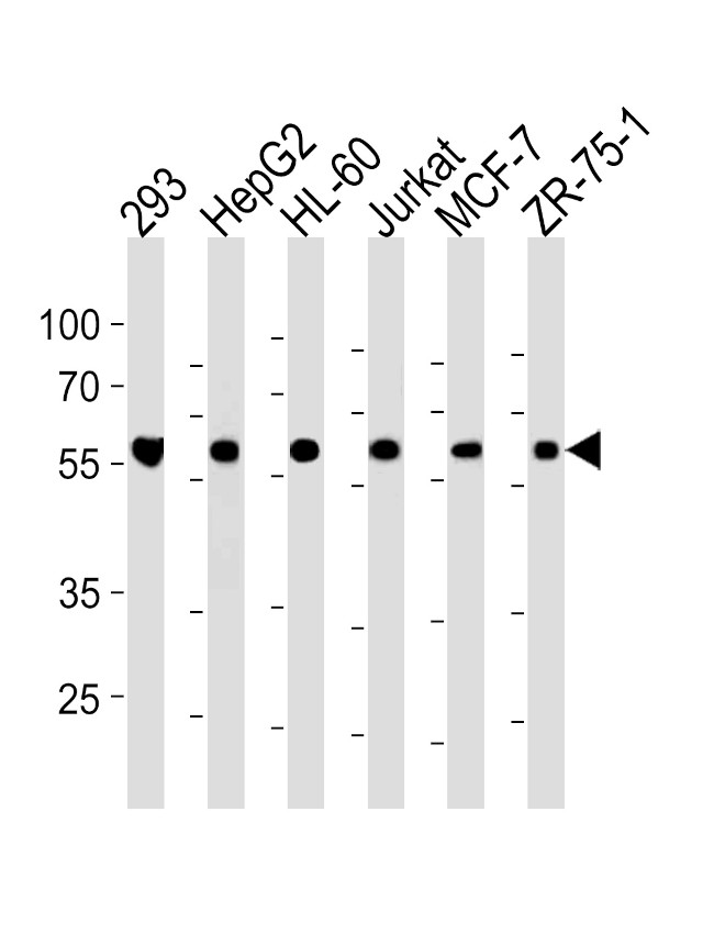 ZRSR2 Antibody in Western Blot (WB)