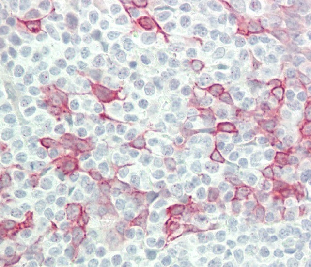 Interferon alpha-4 Antibody in Immunohistochemistry (Paraffin) (IHC (P))