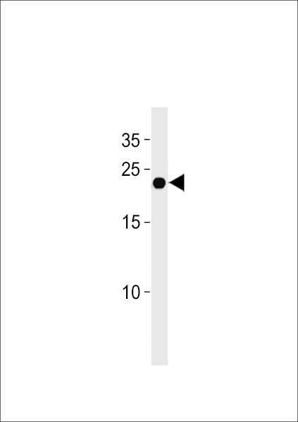 Interferon alpha-4 Antibody in Western Blot (WB)