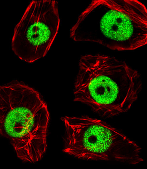 TPD52L3 Antibody in Immunocytochemistry (ICC/IF)