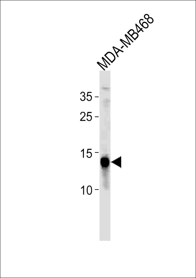 TPD52L3 Antibody in Western Blot (WB)