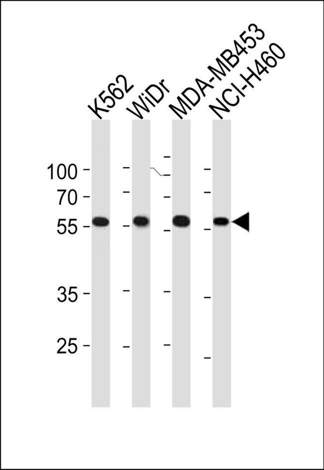 NPIPL2 Antibody in Western Blot (WB)