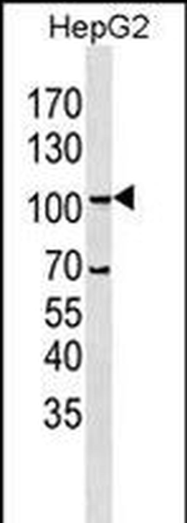 LGR5 Antibody in Western Blot (WB)