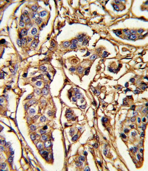 Thrombospondin 1 Antibody in Immunohistochemistry (Paraffin) (IHC (P))