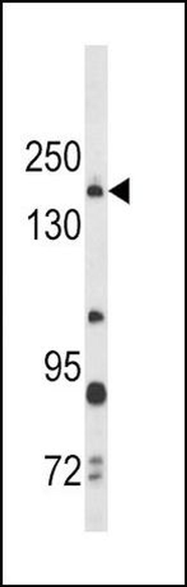 Thrombospondin 1 Antibody in Western Blot (WB)