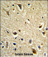 CYP2E1 Antibody in Immunohistochemistry (Paraffin) (IHC (P))