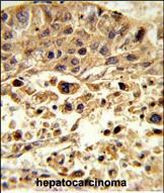 VPS26A Antibody in Immunohistochemistry (Paraffin) (IHC (P))