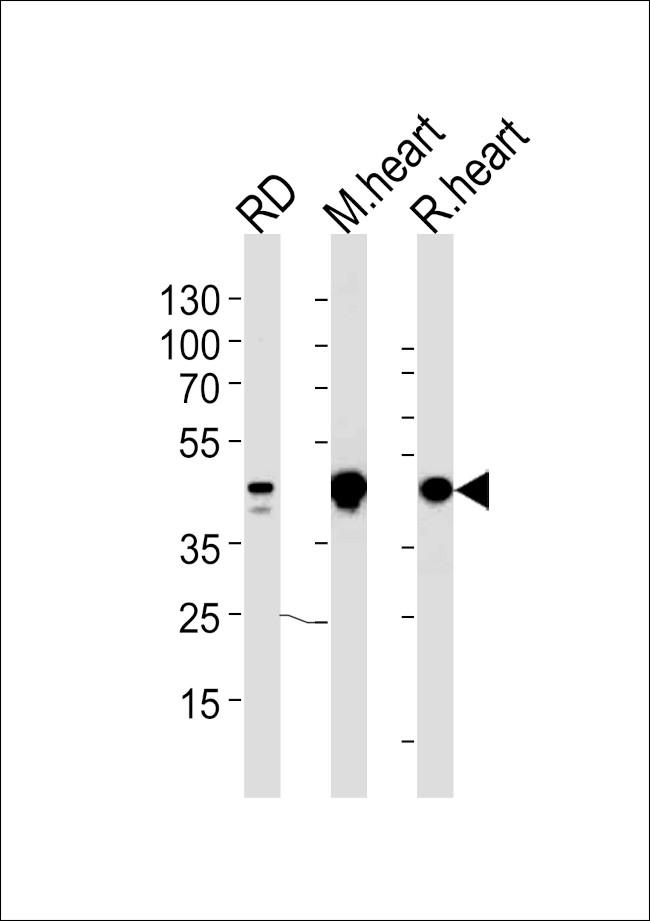 PDK2 Antibody in Western Blot (WB)