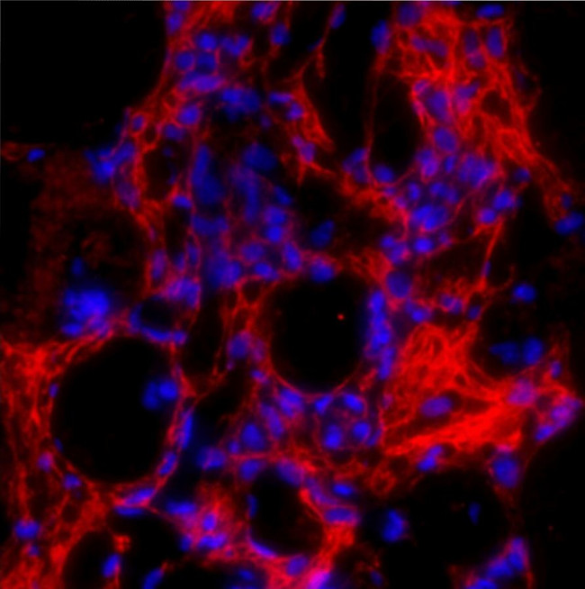 Procollagen I C-Peptide Antibody in Immunohistochemistry (IHC)