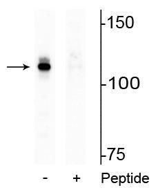 Phospho-Androgen Receptor (Ser94) Antibody in Western Blot (WB)