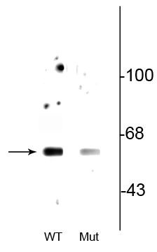 Phospho-Beclin 1 (Ser234) Antibody in Western Blot (WB)