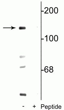 Phospho-NMDAR2C (Ser1096) Antibody in Western Blot (WB)