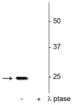 Phospho-SNAP25 (Ser187) Antibody in Western Blot (WB)