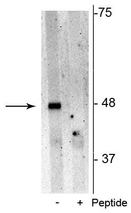 Phospho-SQSTM1 (Ser28) Antibody in Western Blot (WB)