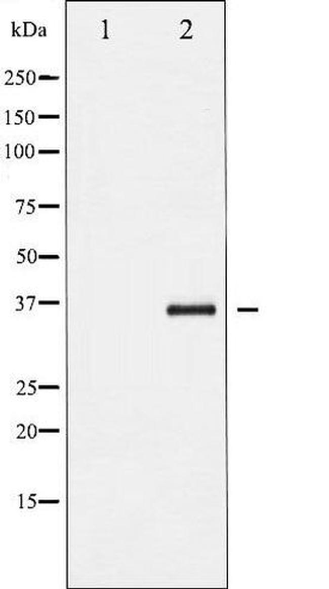 Phospho-I kappa-B-beta (Ser23) Antibody in Western Blot (WB)