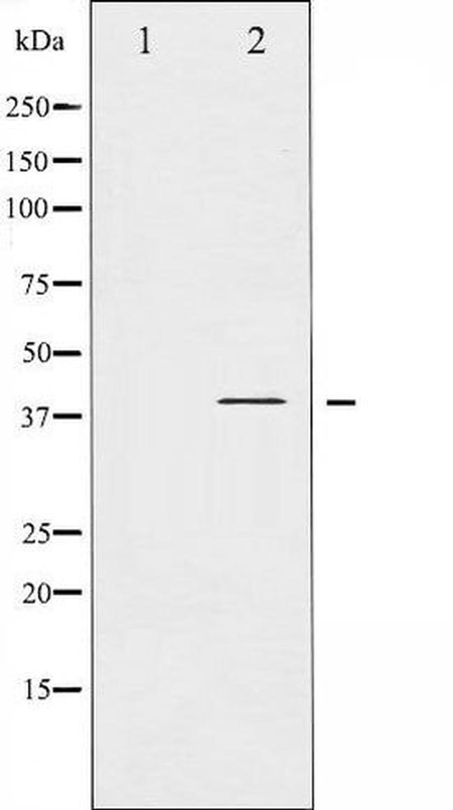 Phospho-I-kappa-B-alpha (Tyr305) Antibody in Western Blot (WB)