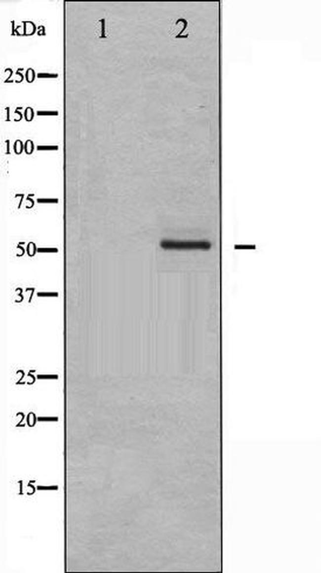 Phospho-Erythropoietin Receptor (Tyr368) Antibody in Western Blot (WB)