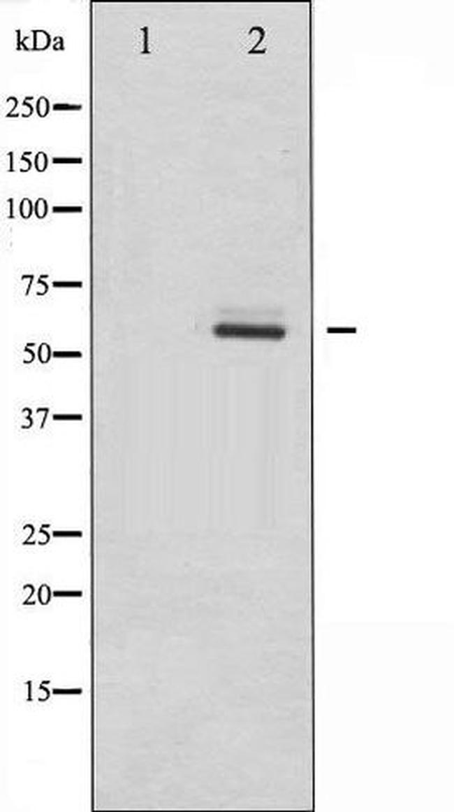 Phospho-DAB1 (Tyr232) Antibody in Western Blot (WB)