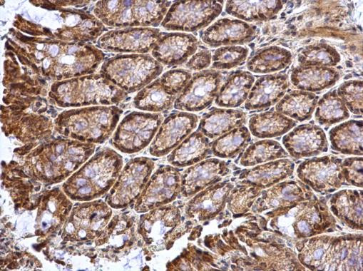 ATOH7 Antibody in Immunohistochemistry (Paraffin) (IHC (P))