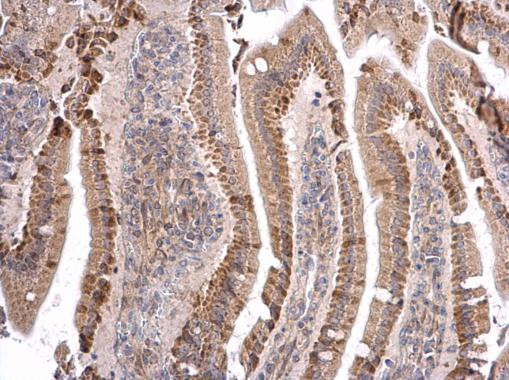 ATOH7 Antibody in Immunohistochemistry (Paraffin) (IHC (P))