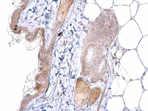 ATOH7 Antibody in Immunohistochemistry (Paraffin) (IHC (P))