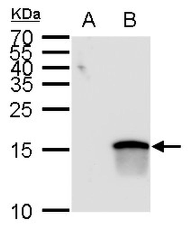 ATOH7 Antibody in Western Blot (WB)